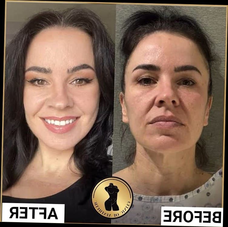 5 Cara Efektif Pakai Foto Before After Klinik Kecantikan untuk Menarik Pasien Baru