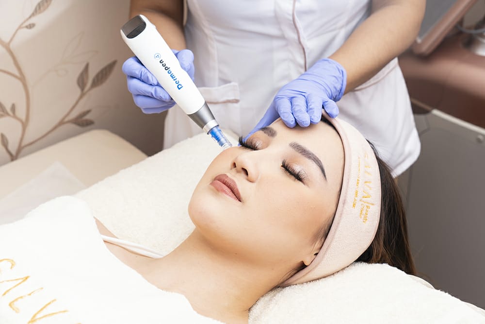 Diskon 15% Microneedling